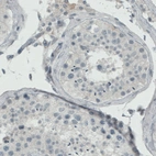 Immunohistochemical staining of human testis shows absence of immunoreactivity (negative control).