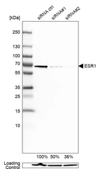 Western blot analysis in MCF-7 cells transfected with control siRNA, target specific siRNA probe #1 and #2, using Anti-ESR1 antibody. Remaining relative intensity is presented. Loading control: Anti-GAPDH.