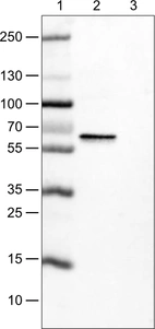 Lane 1: Marker [kDa]_br/_Lane 2: Human cell line MCF-7_br/_Lane 3: Human cell line SK-BR-3