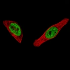 Immunofluorescence staining of MCF7 cells using the Anti-ESR1 monoclonal antibody, showing specific staining in the nucleoplasm in green. Microtubule- and nuclear probes are visualized in red and blue, respectively (where available).