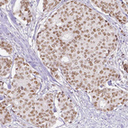 Anti-ERCC1 Antibody