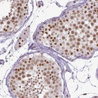 Immunohistochemical staining of human testis shows moderate to strong nuclear positivity in cells in seminiferous ducts.