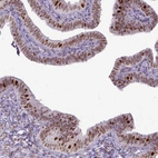 Immunohistochemical staining of human fallopian tube shows moderate to strong nuclear positivity in glandular cells.