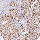 Anti-ERCC1 Antibody