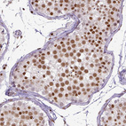 Immunohistochemical staining of human testis shows moderate to strong nuclear positivity in cells in seminiferous ducts.