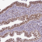 Immunohistochemical staining of human fallopian tube shows moderate to strong nuclear positivity in glandular cells.