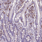 Immunohistochemical staining of human small intestine shows strong membranous positivity in lymphoid cells.