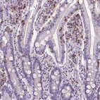 Immunohistochemical staining of human small intestine shows strong membranous positivity in lymphoid cells.