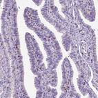 Immunohistochemical staining of human fallopian tube shows moderate membranous positivity in lymphoid cells.