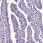 Immunohistochemical staining of human fallopian tube shows moderate membranous positivity in lymphoid cells.