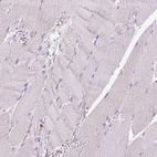 Immunohistochemical staining of human skeletal muscle shows no positivity in striated muscle fibers as expected.