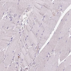 Immunohistochemical staining of human skeletal muscle shows no positivity in striated muscle fibers as expected.