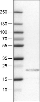 Lane 1: Marker [kDa]_br/_Lane 2: Human tonsil tissue lysate
