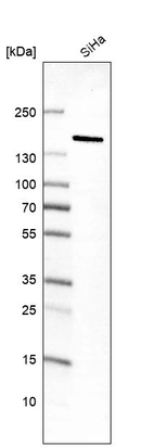 Anti-MKL2 Antibody
