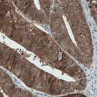 Anti-ASRGL1 Antibody