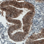 Immunohistochemical staining of human endometrium shows strong immunoreactivity in glandular cells.