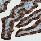 Immunohistochemical staining of human fallopian tube shows strong immunoreactivity in glandular epithelium cells.