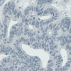 Anti-ASRGL1 Antibody