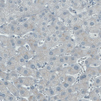 Anti-ASRGL1 Antibody