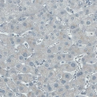 Immunohistochemical staining of human liver shows absence of immunoreactivity (negative control).