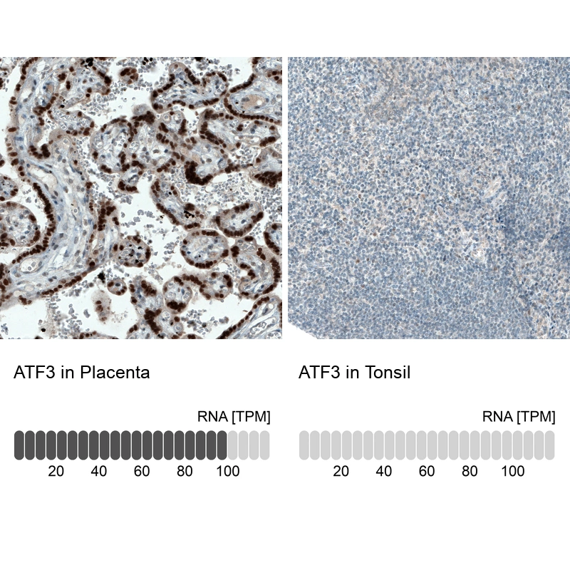 Mouse Monoclonal Anti-ATF3 Antibody - Buy for research - Highly ...
