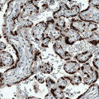 Anti-ATF3 Antibody