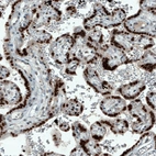 Immunohistochemical staining of human placenta shows strong nuclear positivity in trophoblastic cells.