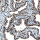 Anti-ATF3 Antibody