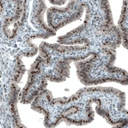 Immunohistochemical staining of human fallopian tube shows moderate to strong nuclear positivity in glandular cells.