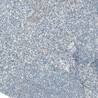 Immunohistochemical staining of human tonsil shows no positivity in lymphoid cells as expected.