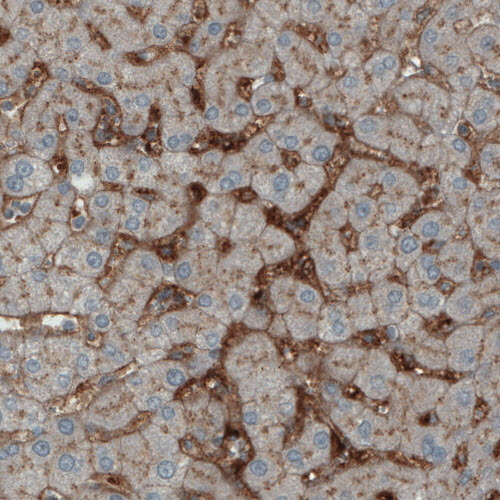 Anti-ITIH4 Antibody