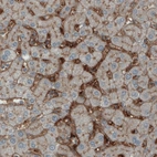 Anti-ITIH4 Antibody