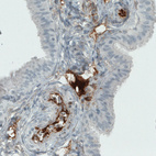 Anti-ITIH4 Antibody