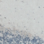 Immunohistochemical staining of human cerebellum shows absence of immunoreactivity (negative control).
