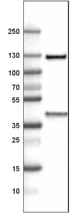 Lane 1: Marker [kDa]_br/_Lane 2: Human liver tissue lysate