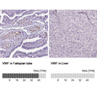 Anti-VWF Antibody