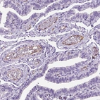 Immunohistochemical staining of human fallopian tube shows moderate cytoplasmic positivity in endothelial cells.