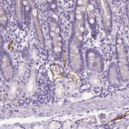 Anti-VWF Antibody