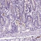 Immunohistochemical staining of human duodenum shows moderate cytoplasmic positivity in endothelial cells.