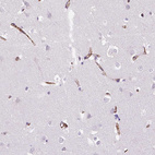 Anti-VWF Antibody