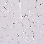 Immunohistochemical staining of human cerebral cortex shows moderate cytoplasmic positivity in endothelial cells.