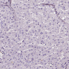 Anti-VWF Antibody