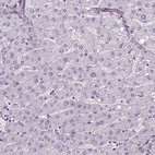 Immunohistochemical staining of human liver shows no positivity in hepatocytes as expected.