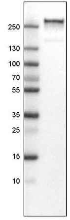 Lane 1: Marker [kDa]_br/_Lane 2: Human plasma