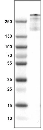 Lane 1: Marker [kDa]_br/_Lane 2: Human spleen tissue lysate