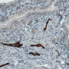 Immunohistochemical staining of human fallopian tube shows strong positivity in blood vessels.