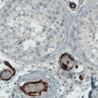 Immunohistochemical staining of human testis shows strong positivity in larger and smaller blood vessels.