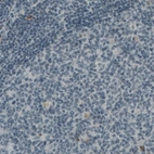 Immunohistochemical staining of human tonsil shows absence of immunoreactivity in lymphoid cells (negative control).