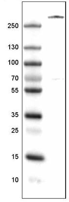 Lane 1: Marker [kDa]_br/_Lane 2: Human spleen tissue lysate
