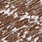 Immunohistochemical staining of human heart muscle shows very strong cytoplasmic positivity in cardiomyocytes.